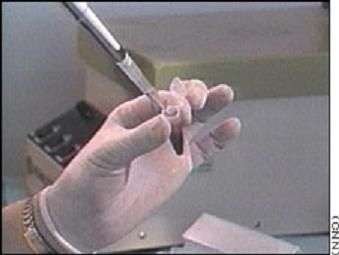 Test Dna