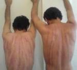 Torture verso i gay in Iran Torture verso i gay in Iran